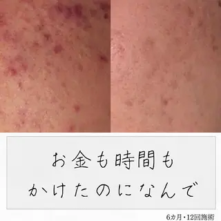 ニキビ経験者が施術 する専門サロン🌻のエステ・リラクイメージ