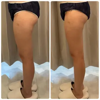 FLEURフェイシャ ル🫧ハーブ🌿小顔のエステ・リラクイメージ