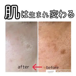 YURUMARU 河ノ瀬店のエステ・リラクイメージ