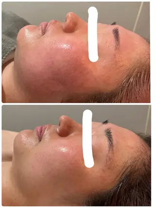 mignon /栄のエステ・リラクイメージ