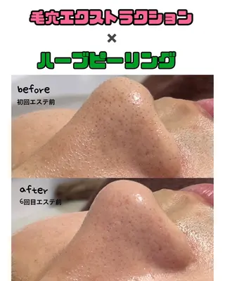 Le'perle。所属・Le'perle。 Kyokaのエステ・リラクイメージ