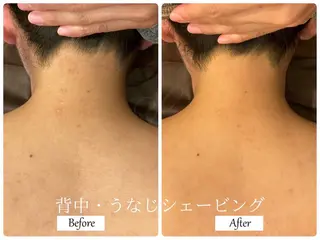 🎀うなじ脱毛🎀 ㅣLino堀江のエステ・リラクイメージ