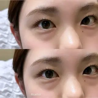 マツエク・マツパ HELLO THERE!🌼のマツエク・マツパデザイン