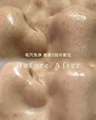 cherir所属・cherir大井町/ 毛穴ニキビ改善専門のエステ・リラクイメージ