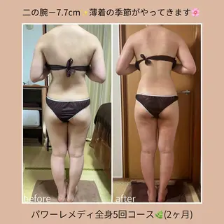 《本気痩せ×疲労改善 》  BILOOPのエステ・リラクイメージ