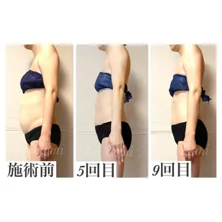 痩身＆ヘッド 長倉絵美のエステ・リラクイメージ