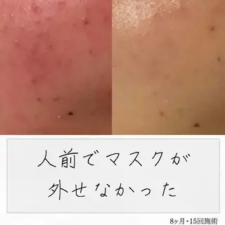 ニキビ経験者が施術 する専門サロン🌻のエステ・リラクイメージ