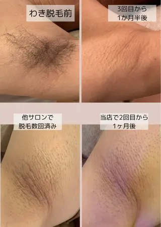 脱毛サロン Arumのエステ・リラクイメージ