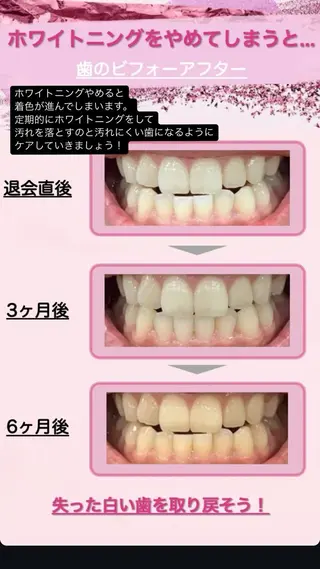 セルフホワイトニング エクシア秋田大町店のその他イメージ