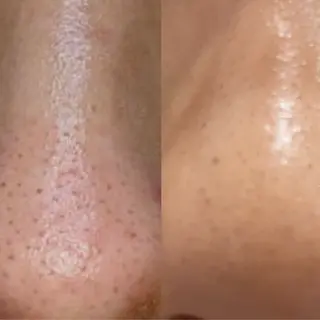 中井 小春のエステ・リラクイメージ