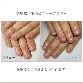 ネイル ネイルサロン アリュームのネイルデザイン