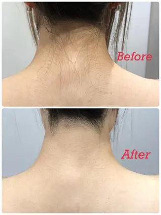 🎀RIA🎀 脱毛/フェイシャルのエステ・リラクイメージ