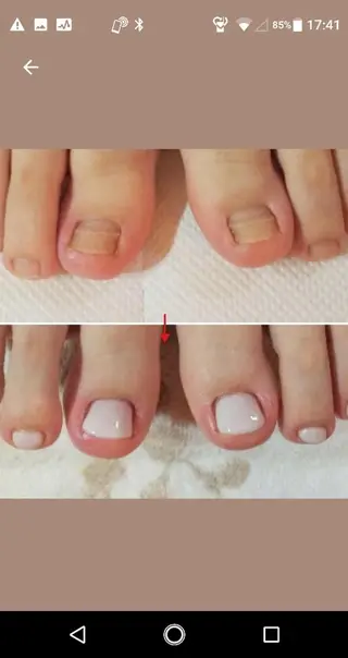 ネイル ネイルサロン アリュームのネイルデザイン