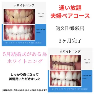 セルフホワイトニング専門店WHITE金沢店所属・伊藤 勢のエステ・リラクイメージ