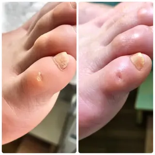 ネイル ⭐️遠藤 夏純⭐️のエステ・リラクイメージ