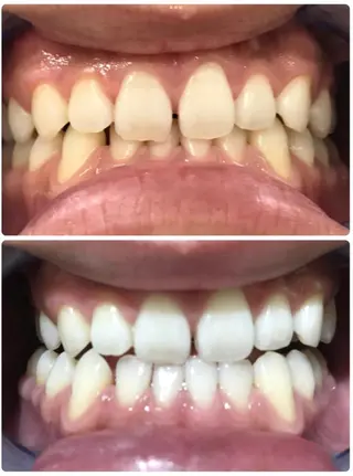 noel de mi 前川亜里沙のエステ・リラクイメージ