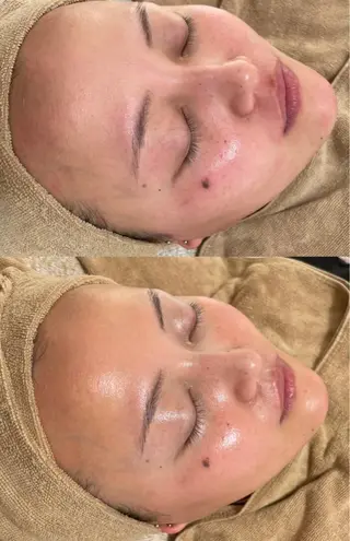 エステサロン Mi-mi.iのエステ・リラクイメージ