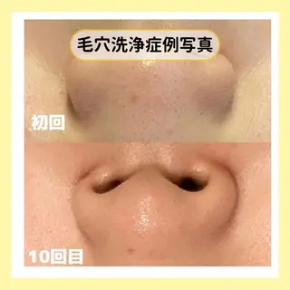 金山/脱毛/美肌 ULULUのエステ・リラクイメージ