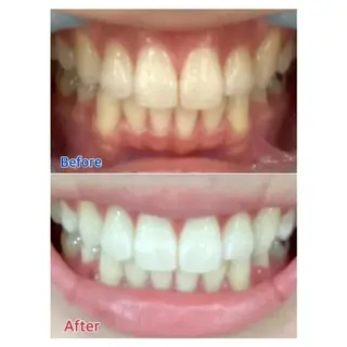 Ｍ渋谷 ホワイトニングのエステ・リラクイメージ