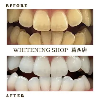 メンズ ホワイトニング ショップ葛西店のその他イメージ