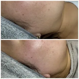 A"-HILU （アーヒル)のエステ・リラクイメージ