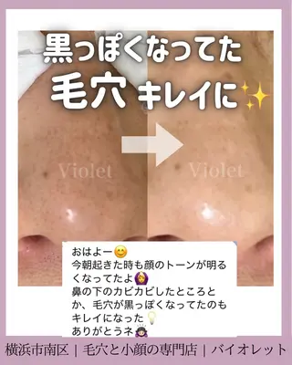 毛穴と耳つぼ専門店 バイオレット　りののその他イメージ