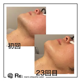 【都度払い脱毛】 RE:  桜木町店のエステ・リラクイメージ