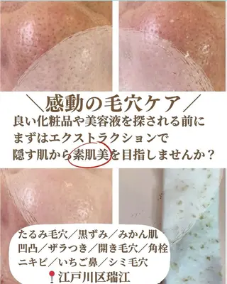 【毛穴専門店】 瑞江|yukaのエステ・リラクイメージ