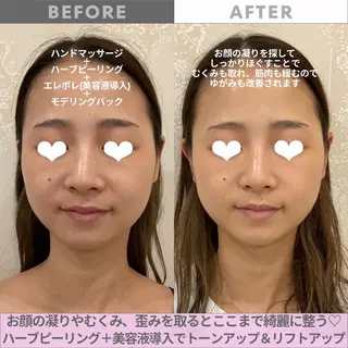 リンデザ 山口のエステ・リラクイメージ