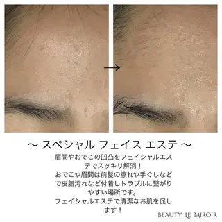 ビューティー ミロワールのエステ・リラクイメージ
