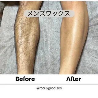 メンズ 脱毛サロンCheer momoのエステ・リラクイメージ