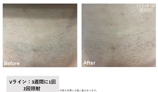 viage所属・viage 脱毛&フェイシャル店のエステ・リラクイメージ