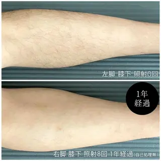 メンズ 脱毛サロン  Relight所属・脱毛サロン Relightのエステ・リラクイメージ