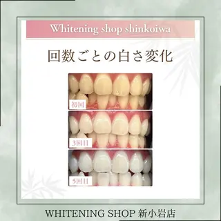 メンズ ホワイトニング ショップ新小岩店のその他イメージ