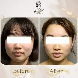 💎allilin 五所川原💎本間のエステ・リラクイメージ