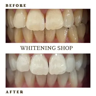 メンズ ホワイトニング ショップ葛西店のその他イメージ