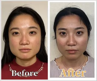 整体 LALUZ中目黒のその他イメージ