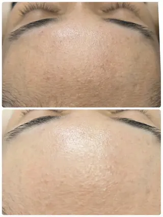 LAKI eye&face studio所属・laki studioのマツエク・マツパデザイン