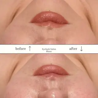 頭蓋骨小顔矯正 ハーブピーリングのエステ・リラクイメージ