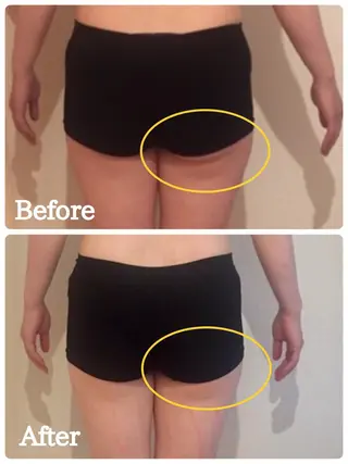 リプラス整体院所属・Re+(リプラス整体 院:やまみち)のエステ・リラクイメージ