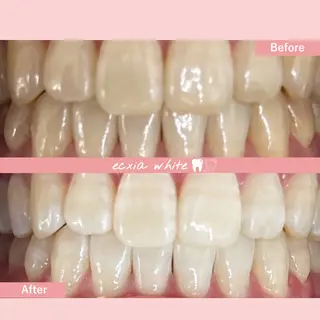 セルフホワイトニング エクシア札幌琴似店のその他イメージ