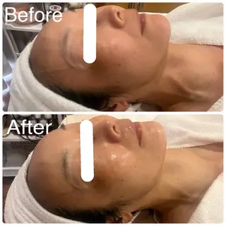 毛穴＆ホワイトニング mielのエステ・リラクイメージ