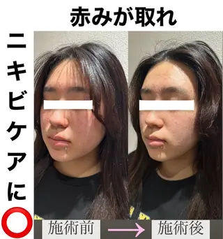 脱毛&美容サロン BLUESEAのエステ・リラクイメージ