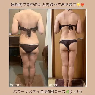 《本気痩せ×疲労改善 》  BILOOPのエステ・リラクイメージ