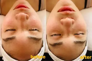 Beauty Zionのエステ・リラクイメージ