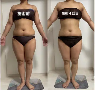 IBERIA心斎橋店 🌼凝り小顔美肌痩身のエステ・リラクイメージ