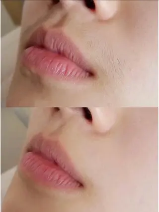 メンズ Queen Salonのエステ・リラクイメージ