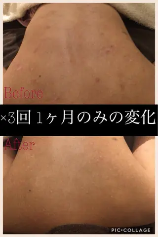 ミディアム カラー パーマ ヘアアレンジ メンズ キッズ ネイル マツエク・マツパ ニキビ・肌質改善専門 ♡人生が変わるサロンのエステ・リラクイメージ