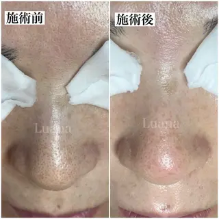 マツヤニWax専門/ 岸和田/Luanaのエステ・リラクイメージ