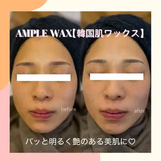 アイブロウ Lea堺東　毛穴洗浄 ×顔ワックス脱毛のエステ・リラクイメージ